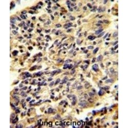 Glypican 1 (GPC1) Antibody