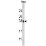 Histone Cluster 1 H1 Family Member C (HIST1H1C) Antibody