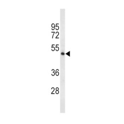 Tryptophan Hydroxylase 2 (TPH2) Antibody