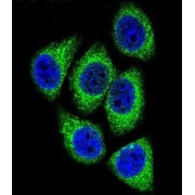 DEK Oncogene (DEK) Antibody