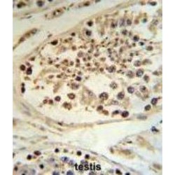 DEK Oncogene (DEK) Antibody