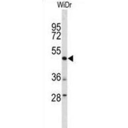 DEK Oncogene (DEK) Antibody