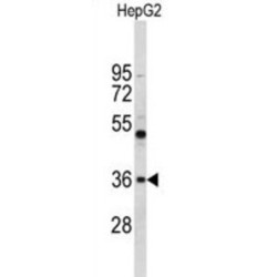 ELOVL Fatty Acid Elongase 2 (ELOVL2) Antibody