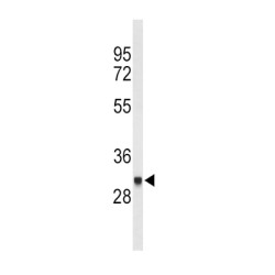 Putative High Affinity Immunoglobulin Gamma Fc Receptor IB (FCGR1B) Antibody