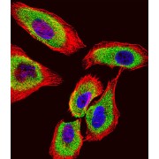 Glutathione S-Transferase P (GSTP1) Antibody