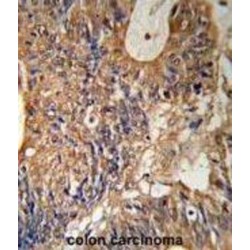 Glutathione S-Transferase P (GSTP1) Antibody
