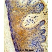 Polyunsaturated Fatty Acid Lipoxygenase ALOX15B (ALOX15B) Antibody