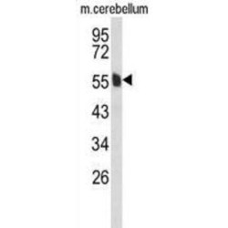 MAGUK P55 Subfamily Member 6 (MPP6) Antibody