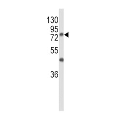 Polypeptide N-Acetylgalactosaminyltransferase 3 (GALNT3) Antibody