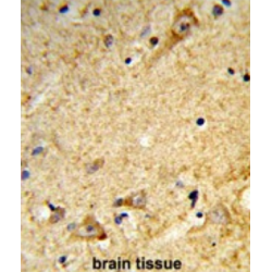 Major Allergen Mal D 2 (MALD2) Antibody