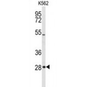 WB analysis of human lung tissue, using CLDN18 antibody (1/2000 dilution).