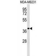 Exostoses (Multiple)-Like 2 (EXTL2) Antibody