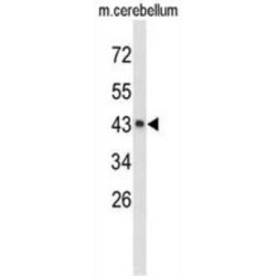 Exostoses (Multiple)-Like 2 (EXTL2) Antibody