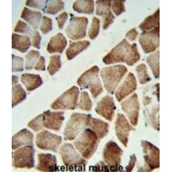 ATP Synthase Subunit Gamma, Mitochondrial (ATP5F1C) Antibody