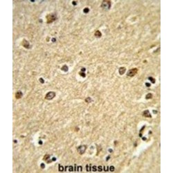 Phospholipase C Beta 2 (PLCB2) Antibody