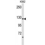 WB analysis of K562 cell lysates.