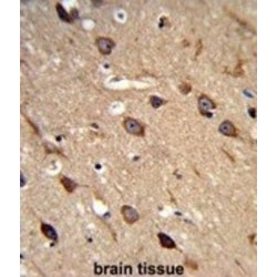 Acid-Sensing Ion Channel 1 (ACCN2) Antibody