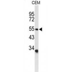 Acid-Sensing Ion Channel 1 (ACCN2) Antibody