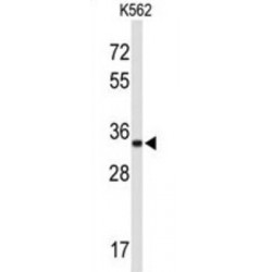 ATPase, Na+/K+ Transporting Beta 2 Polypeptide (ATP1B2) Antibody