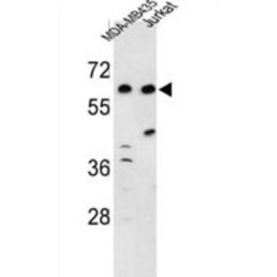 C19orf26 Antibody