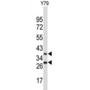 F-Box Only Protein 4 (FBXO4) Antibody