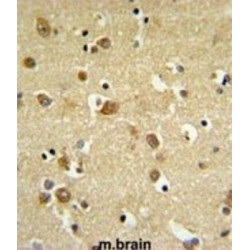 Gamma-Aminobutyric Acid Receptor Subunit Delta (gABRD) Antibody