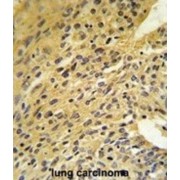 Coenzyme Q5, Methyltransferase (COQ5) Antibody