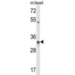 Coenzyme Q5, Methyltransferase (COQ5) Antibody