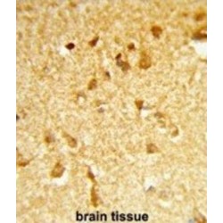 DEAD (Asp-Glu-Ala-Asp) Box Polypeptide 17 (DDX17) Antibody