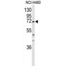 DEAD (Asp-Glu-Ala-Asp) Box Polypeptide 17 (DDX17) Antibody
