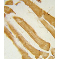 Inositol-Trisphosphate 3-Kinase C (ITPKC) Antibody