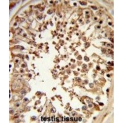 Meiotic Recombination Protein DMC1/LIM15 Homolog (DMC1) Antibody