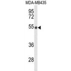 Meiotic Recombination Protein DMC1/LIM15 Homolog (DMC1) Antibody