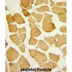 Eyes Absent Homolog 4 (EYA4) Antibody