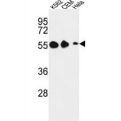 Galanin Receptor Type 1 (GALR1) Antibody