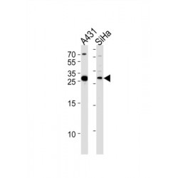 17-Beta-Hydroxysteroid Dehydrogenase Type 12 (HSD17B12) Antibody