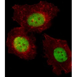 TREF1 Antibody