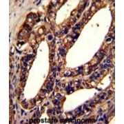 Calcium Release-Activated Calcium Channel Protein 1 (ORAI1) Antibody