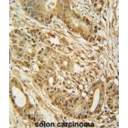 DNA Replication Licensing Factor MCM2 (MCM2) Antibody