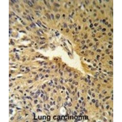 Component of Oligomeric Golgi Complex 2 (COG2) Antibody