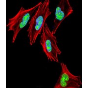 T-Box Protein 1 (TBX1) Antibody