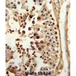 Calcineurin Subunit B Type 2 (PPP3R2) Antibody