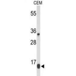 DIRAS Family, GTP-Binding RAS-Like 1 (DIRAS1) Antibody