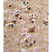 Alpha 1B Adrenergic Receptor (ADRA1B) Antibody