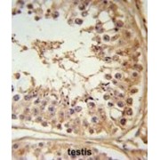 F-Box/LRR-Repeat Protein 5 (FBXL5) Antibody