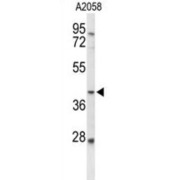 abx034362