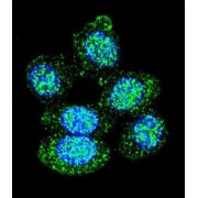 Acid Phosphatase 1 (ACP1) Antibody