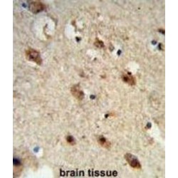 Acid Phosphatase 1 (ACP1) Antibody