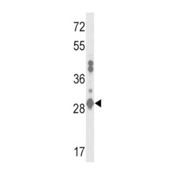 Glutathione S-Transferase A2 (GSTA2) Antibody