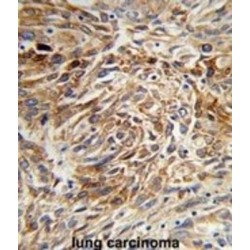 Anterior Gradient Protein 3 (AGR3) Antibody
